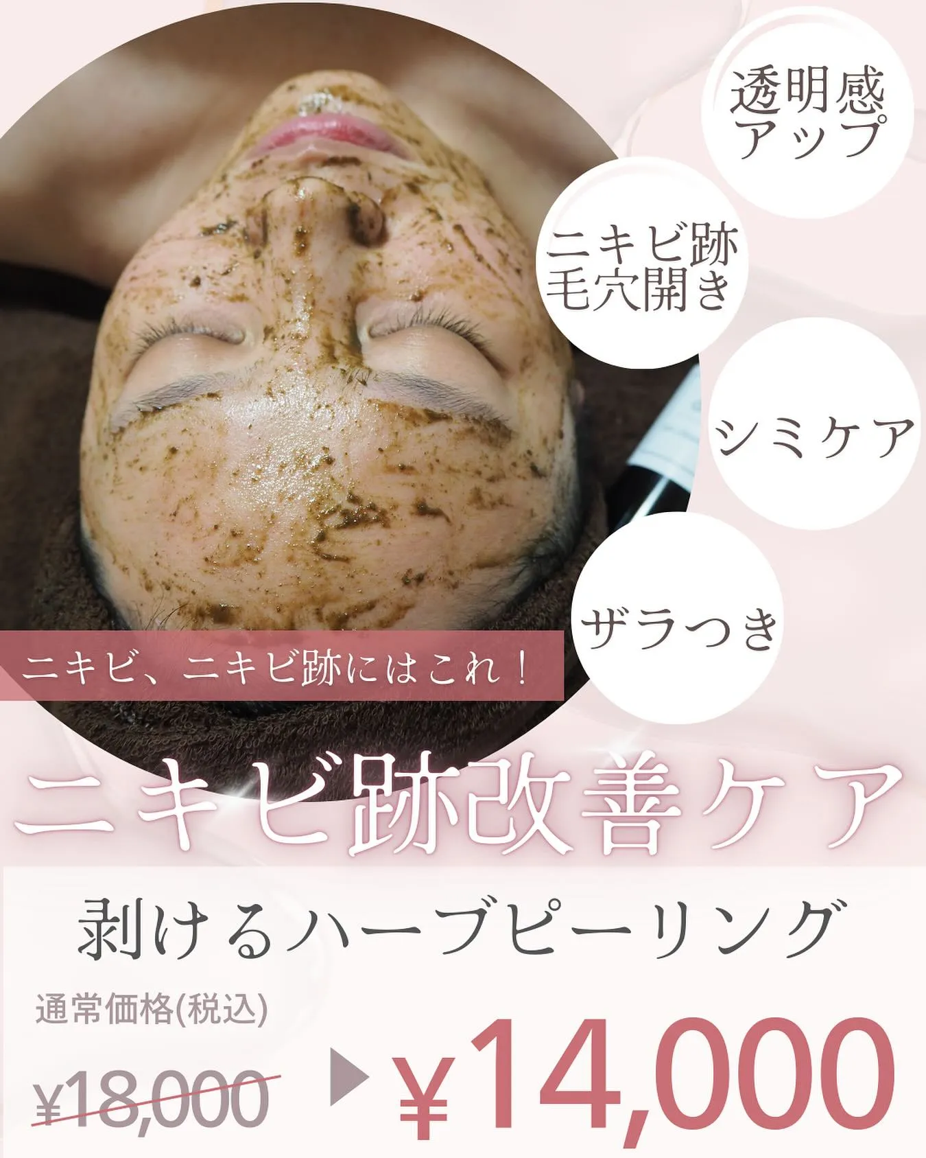 スピキュールが通常の8倍配合された剥けるハーブピーリング🌿