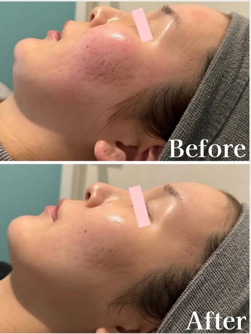 ＼ 剥けても剥けなくても、肌は変わる 🌿 ／