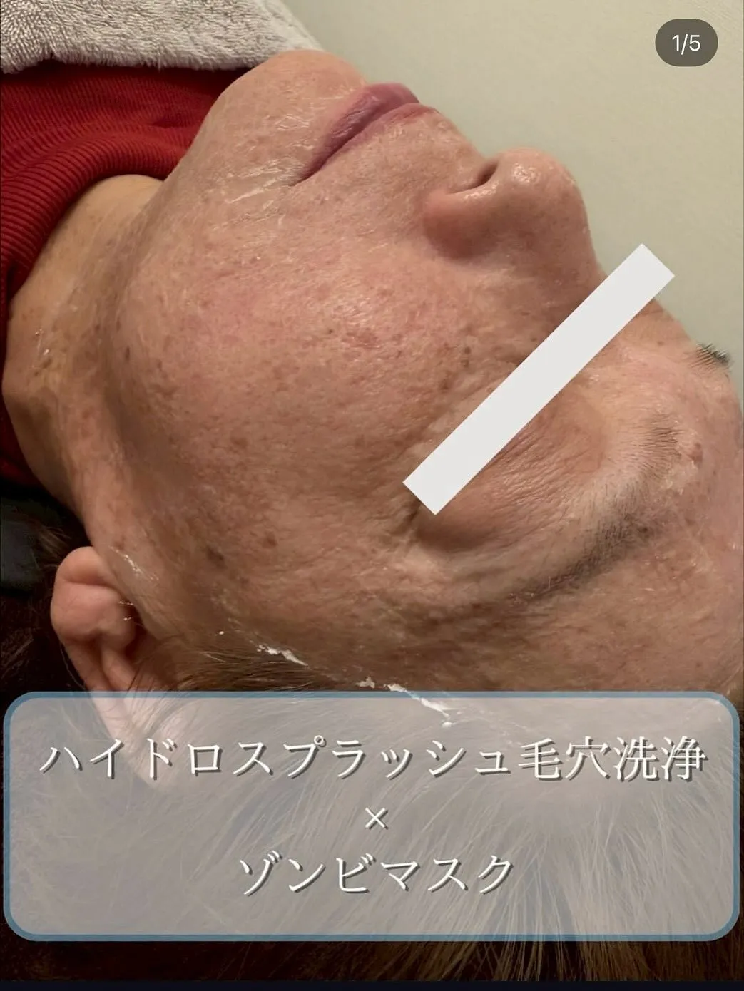 ハイドロスプラッシュ毛穴洗浄×ゾンビマスク🧟‍♂️