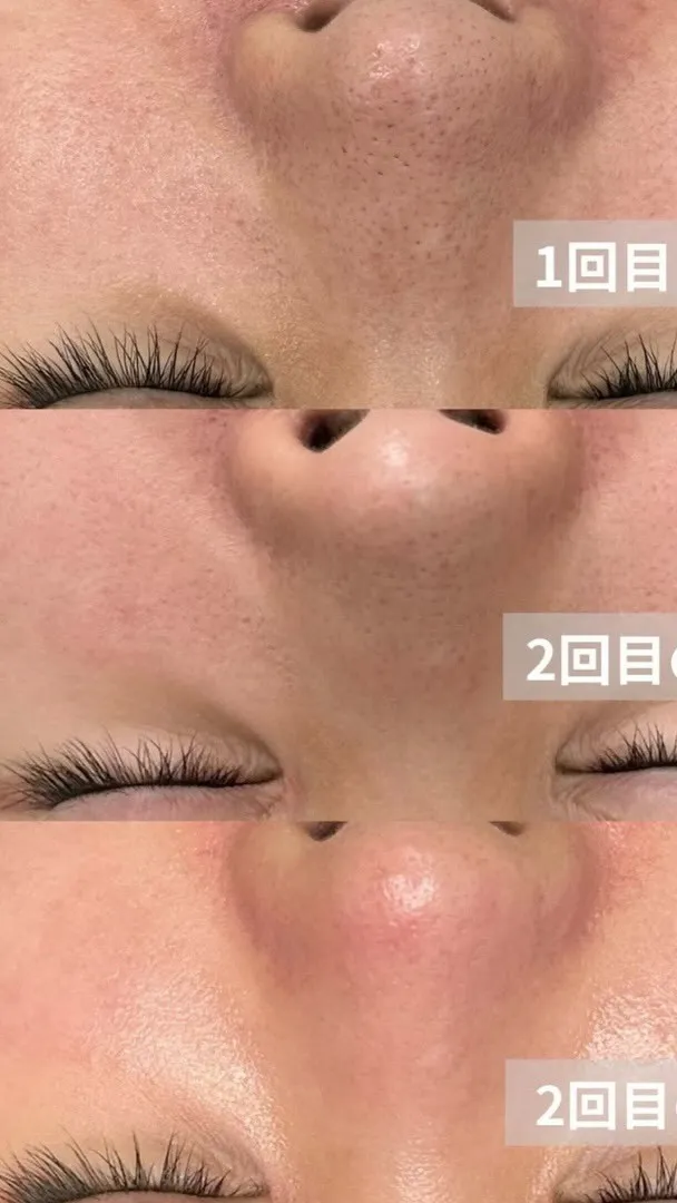 当店では韓国で人気な施術を提供しております。